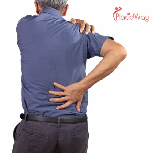 7 gute Gründe für eine Rotatorenmanschetten-OP in der Türkei